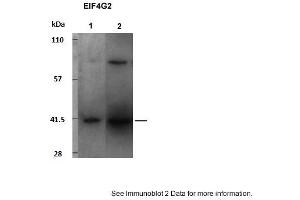 Image no. 2 for anti-Eukaryotic Translation Initiation Factor 4 gamma 2 (EIF4G2) (C-Term) antibody (ABIN2778773)