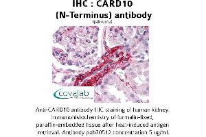 Image no. 1 for anti-Caspase Recruitment Domain Family, Member 10 (CARD10) antibody (ABIN1732633)