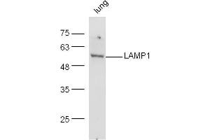 Image no. 5 for anti-Lysosomal-Associated Membrane Protein 1 (LAMP1) (AA 301-417) antibody (ABIN676088)