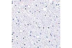 Image no. 1 for anti-TP53 induced glycolysis regulatory phosphatase (TIGAR) (Center) antibody (ABIN500907)