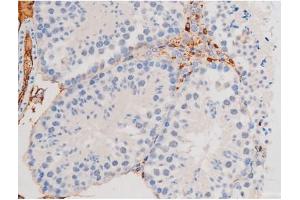 Image no. 3 for anti-Signal Transducer and Activator of Transcription 1, 91kDa (STAT1) (pSer727) antibody (ABIN6256410)