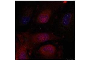 Image no. 4 for anti-Jun D Proto-Oncogene (JUND) (Ser255) antibody (ABIN197142)
