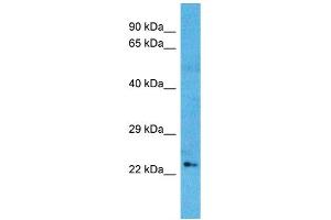 Image no. 1 for anti-Odd-Skipped Related 1 (OSR1) (N-Term) antibody (ABIN2779514)