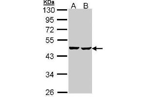 Image no. 1 for anti-Succinate-CoA Ligase, ADP-Forming, beta Subunit (SUCLA2) (Center) antibody (ABIN2856701)