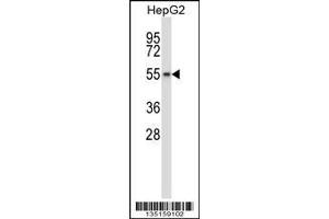 Image no. 2 for anti-WEE1 Homolog 2 (S. Pombe) (WEE2) (Center) antibody (ABIN2494090)