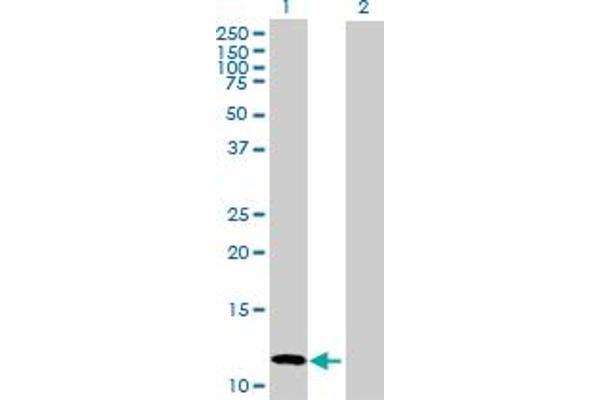 CALCB antibody  (AA 1-127)