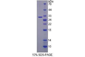 Image no. 1 for Uridine-Cytidine Kinase 2 (UCK2) (AA 18-261) protein (His tag) (ABIN6238577)
