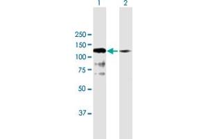 Image no. 2 for anti-Sorting Nexin 19 (SNX19) (AA 1-803) antibody (ABIN949971)