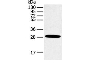 Western blot analysis of Human normal lung tissue using CLDN25 Polyclonal Antibody at dilution of 1:250