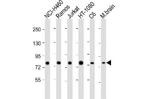 Image no. 2 for anti-Glycyl-tRNA Synthetase (GARS) (AA 706-739), (C-Term) antibody (ABIN392465)