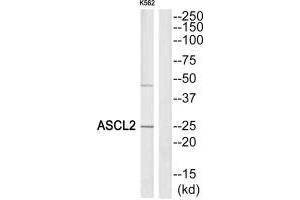 ASCL2 抗体