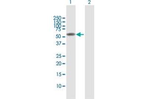 Western Blot analysis of SPATA2 expression in transfected 293T cell line by SPATA2 MaxPab polyclonal antibody.