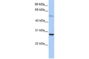 Image no. 1 for anti-MAX Dimerization Protein 1 (MXD1) (N-Term) antibody (ABIN2780418)