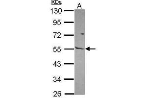 Image no. 3 for anti-Matrix Metallopeptidase 13 (Collagenase 3) (MMP13) (Internal Region) antibody (ABIN2854829)