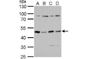 WB Image PKA R2 antibody detects PKA R2 protein by Western blot analysis.