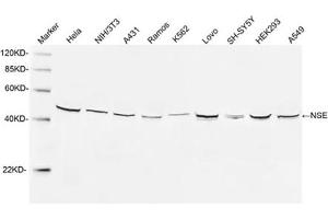 Image no. 1 for anti-Enolase 2 (Gamma, Neuronal) (ENO2) (N-Term) antibody (ABIN1574103)