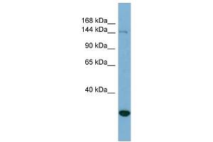Image no. 2 for anti-Jumonji, AT Rich Interactive Domain 2 (JARID2) (N-Term) antibody (ABIN2787847)