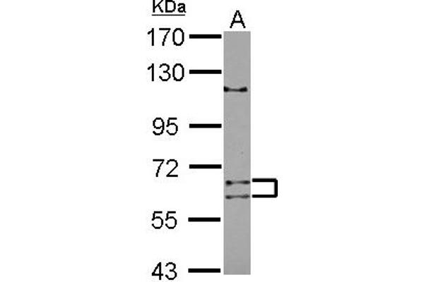 anti-Adenosine Deaminase Domain Containing 1 (Testis-Specific) (ADAD1) (AA 1-307) antibody