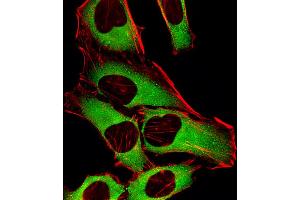 Image no. 1 for anti-Cartilage Associated Protein (CRTAP) (AA 31-59), (N-Term) antibody (ABIN5532526)