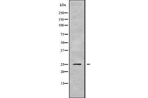 Image no. 1 for anti-Proteasome (Prosome, Macropain) 26S Subunit, Non-ATPase, 9 (PSMD9) (N-Term) antibody (ABIN6264492)