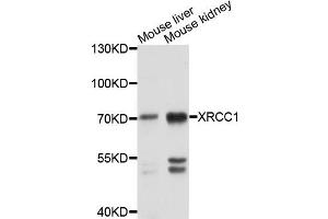 Image no. 2 for anti-X-Ray Repair Complementing Defective Repair in Chinese Hamster Cells 1 (XRCC1) antibody (ABIN1875363)