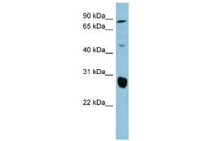 anti-Solute Carrier Family 26, Member 4 (SLC26A4) (Middle Region) antibody