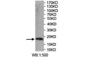 Image no. 1 for anti-Synaptotagmin XIV (SYT14) (AA 272-459) antibody (ABIN5892031)