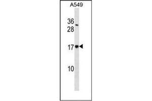 Image no. 1 for anti-Signal Sequence Receptor, delta (SSR4) (AA 97-126), (Middle Region) antibody (ABIN954957)