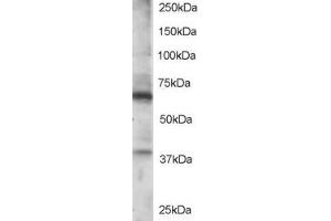 Image no. 1 for anti-Regulator of G-Protein Signaling 14 (RGS14) (C-Term) antibody (ABIN185233)