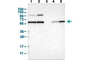 Image no. 1 for anti-Protein Phosphatase, Mg2+/Mn2+ Dependent, 1B (PPM1B) (AA 359-463) antibody (ABIN5774361)