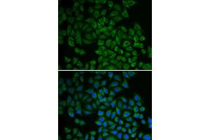 Image no. 5 for anti-serum/glucocorticoid Regulated Kinase 1 (SGK1) antibody (ABIN3021291)