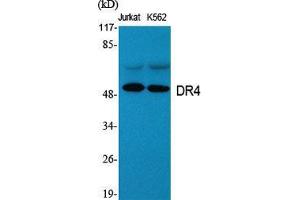 Image no. 2 for anti-Drought-Repressed 4 Protein (DR4) (C-Term) antibody (ABIN3184356)