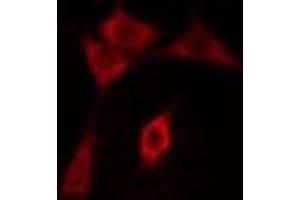 Image no. 1 for anti-rho Guanine Nucleotide Exchange Factor (GEF) 3 (ARHGEF3) (C-Term) antibody (ABIN6258558)