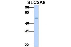 Image no. 3 for anti-Solute Carrier Family 2 (Facilitated Glucose Transporter) Member 8 (SLC2A8) (Middle Region) antibody (ABIN2781642)