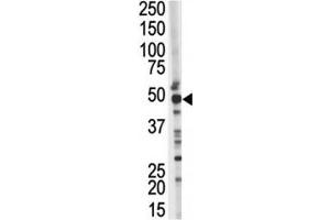Image no. 2 for anti-Tumor Susceptibility Gene 101 (TSG101) (AA 1-30) antibody (ABIN3029402)
