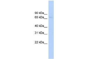 Image no. 1 for anti-ATP-Binding Cassette, Sub-Family F (GCN20), Member 2 (ABCF2) (Middle Region) antibody (ABIN2781515)