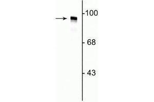 Image no. 2 for anti-Dynamin 1 (DNM1) (N-Term) antibody (ABIN361522)