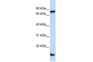 Image no. 1 for anti-Zinc Finger Protein 281 (ZNF281) (Middle Region) antibody (ABIN2780888)