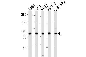 Image no. 4 for anti-Procollagen-Lysine,2-Oxoglutarate 5-Dioxygenase 1 (PLOD1) (AA 66-94), (N-Term) antibody (ABIN656585)