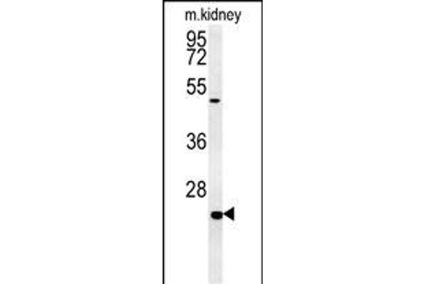 SHISA2 antibody  (C-Term)