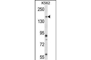 Image no. 2 for anti-Pseudopodium-Enriched Atypical Kinase 1 (PEAK1) (AA 1188-1216) antibody (ABIN5539293)