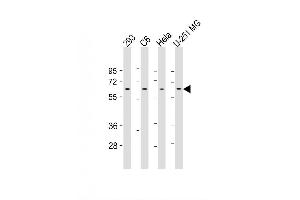 Image no. 2 for anti-YY1 Transcription Factor (YY1) antibody (ABIN1882292)