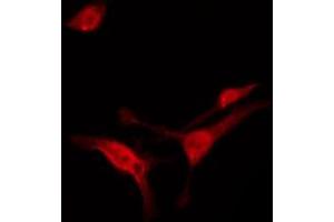 Image no. 5 for anti-FYN Oncogene Related To SRC, FGR, YES (FYN) (pTyr530) antibody (ABIN6256757)