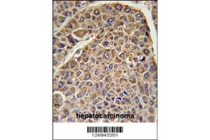Immunohistochemistry (IHC) image for anti-Dihydrolipoyl Transacetylase (DLAT) antibody (ABIN2160605)