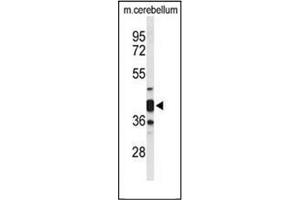 Image no. 2 for anti-Cytohesin 3 (CYTH3) (AA 371-400), (C-Term) antibody (ABIN951804)