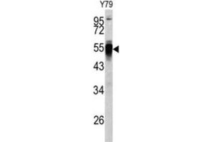 Image no. 3 for anti-Protein Disulfide Isomerase Family A, Member 6 (PDIA6) antibody (ABIN3002737)
