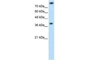 Image no. 3 for anti-Thiosulfate Sulfurtransferase (Rhodanese) (TST) antibody (ABIN631012)