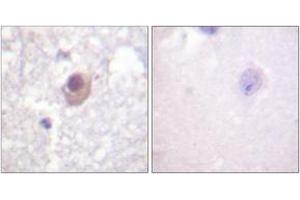 Image no. 2 for anti-serum/glucocorticoid Regulated Kinase 1 (SGK1) (AA 41-90) antibody (ABIN1532486)