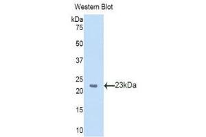 anti-Slit Homolog 2 (Drosophila) (SLIT2) (AA 31-197) antibody