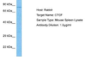 Image no. 1 for anti-CCCTC-Binding Factor (Zinc Finger Protein) (CTCF) (C-Term) antibody (ABIN2777204)